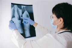 重症肺炎别漏诊！DNA+RNA 双检流程精准识别混合感染
